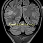 TSR Watermark - 33