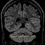 TSR Watermark - 34