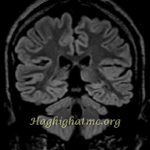 TSR Watermark - 36