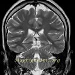 TSR Watermark - 38