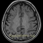 TSR Watermark - 41