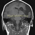 TSR Watermark - 50