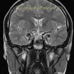 TSR Watermark - 53
