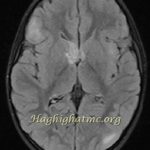 TSR Watermark - 55