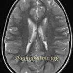 TSR Watermark - 57
