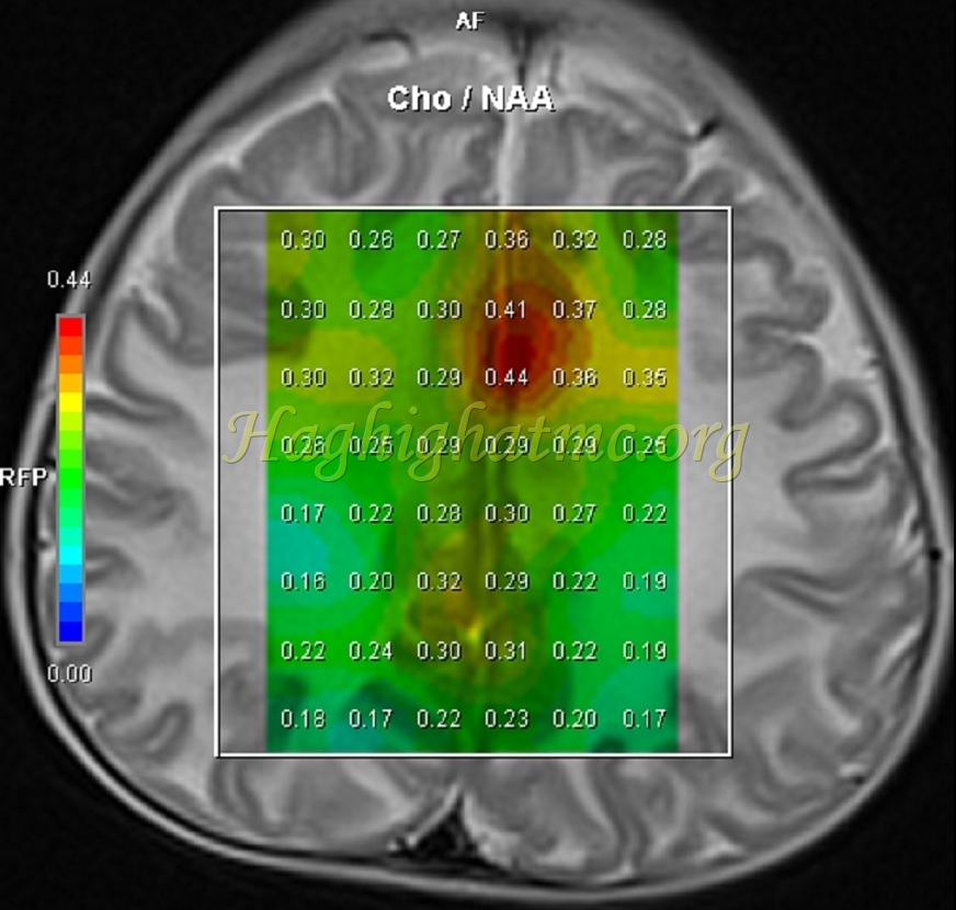 Ped neuro1 a