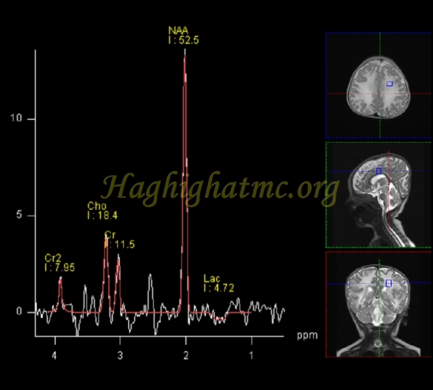 Ped neuro1 b