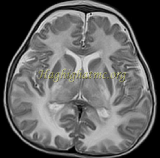 Ped neuro1 c