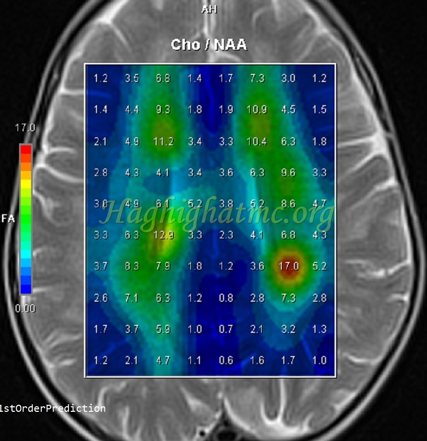 Ped neuro2 a