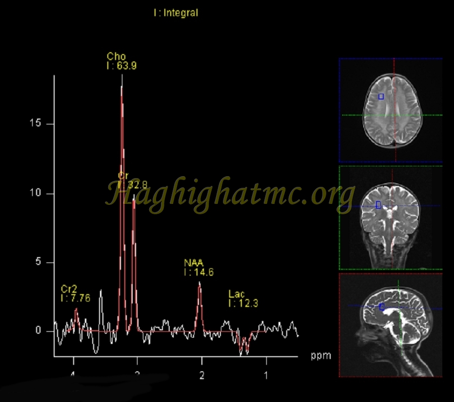 Ped neuro2 b