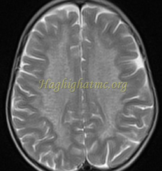 Ped neuro2 d
