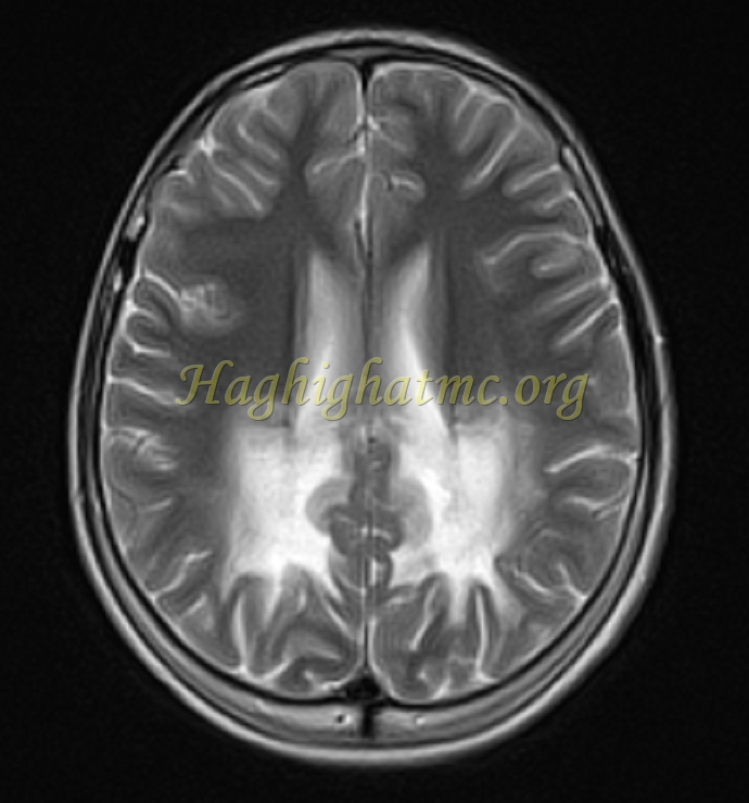 Ped neuro3 a
