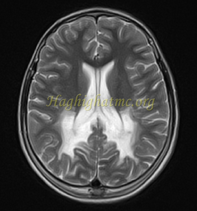 Ped neuro3 b