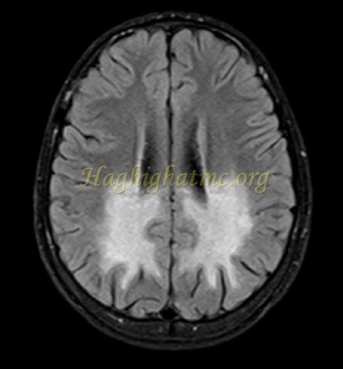 Ped neuro3 c