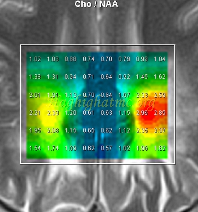Ped neuro3 d