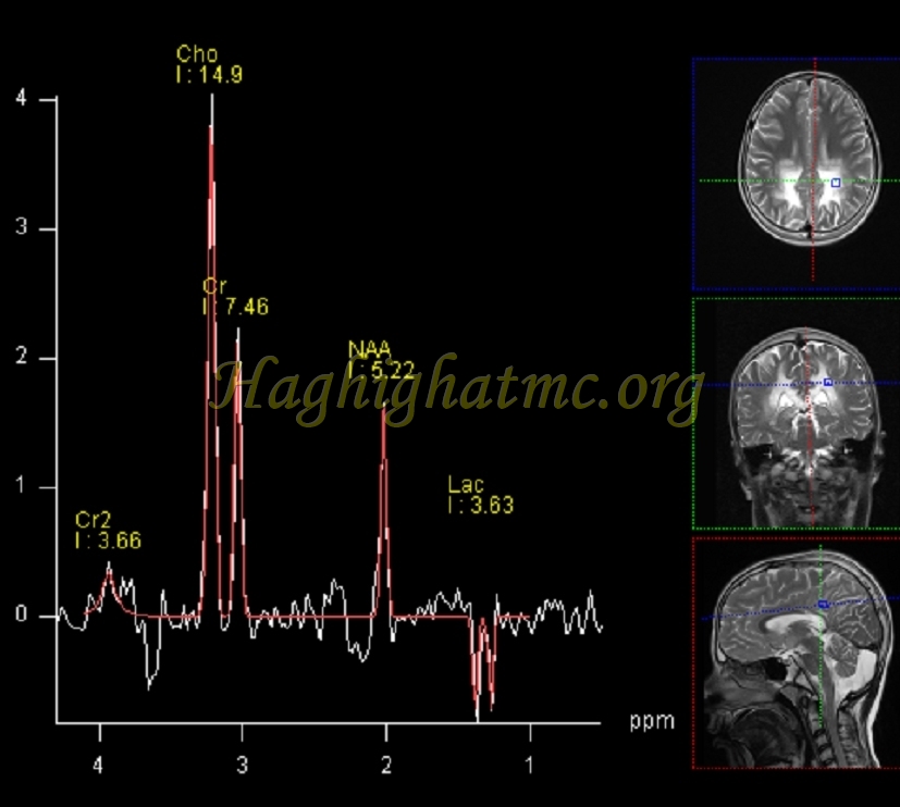 Ped neuro3 e