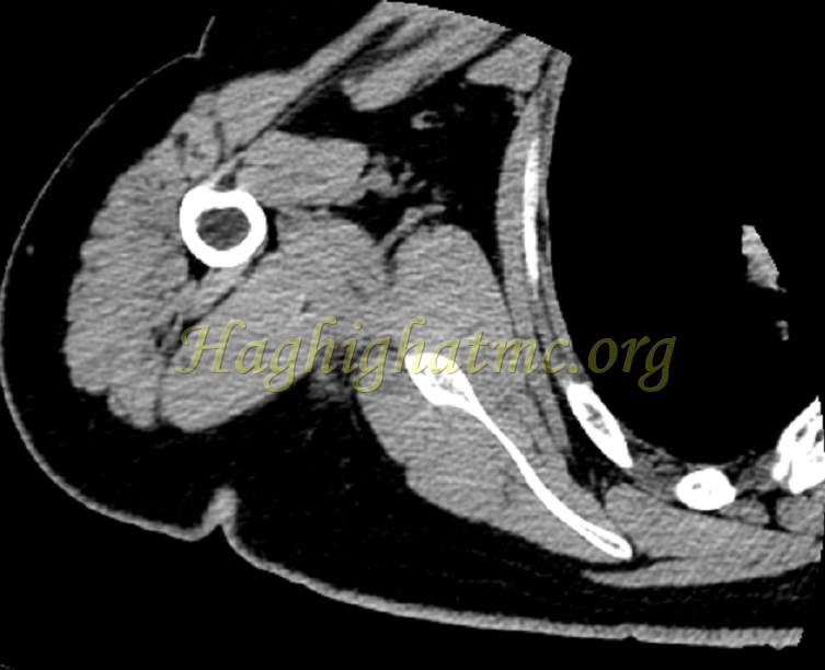 Xray2