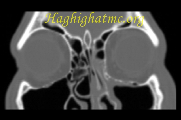 Xray4