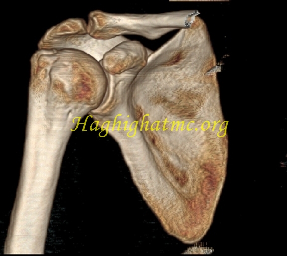 Xray7