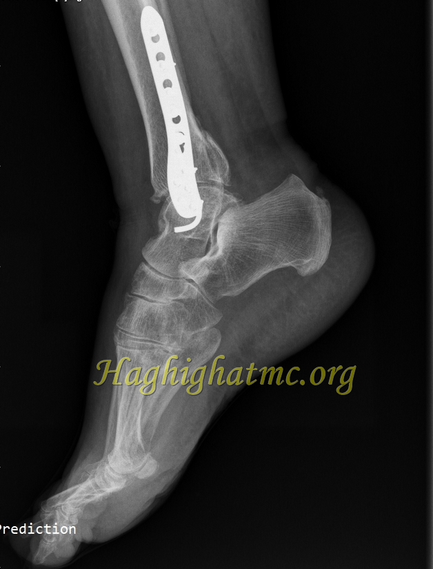 Xray8