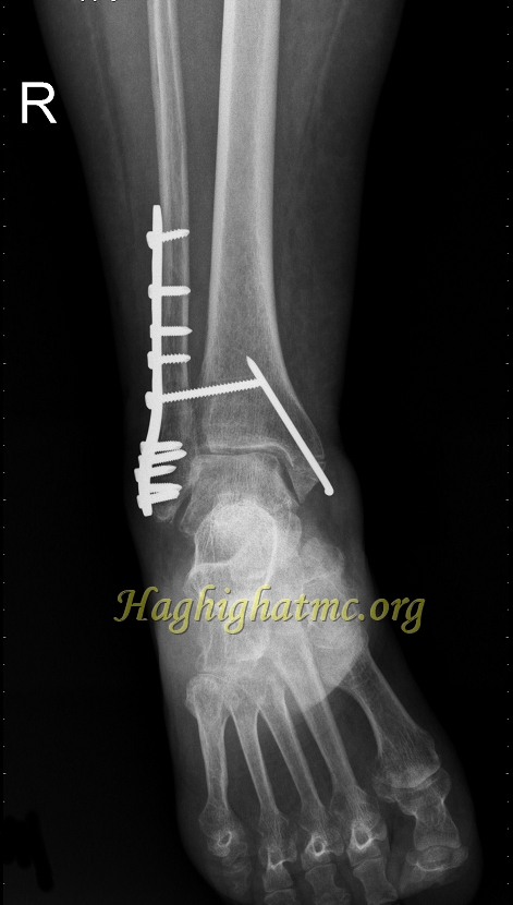 Xray9