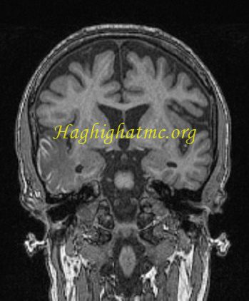 infective-1-e1733261631839.jpg