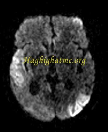 infective-4.jpg
