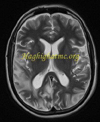 infective-Icon-e1733261682516.jpg