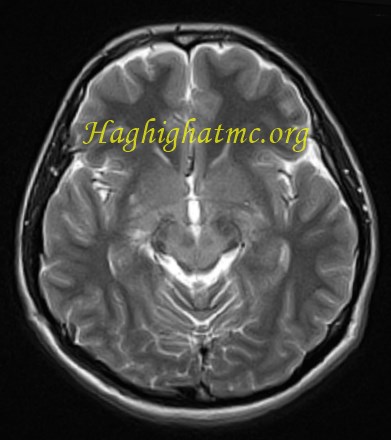 infective-case2-1.jpg