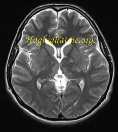 infective-case2-2.jpg
