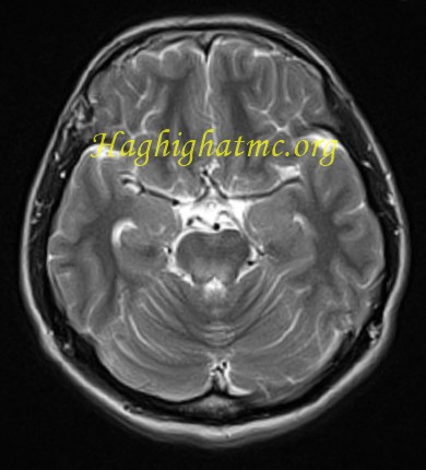 infective-case2-3.jpg