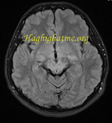 infective-case2-4.jpg