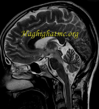 infective-case2-6.jpg