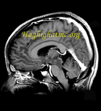 infective case2 (7)