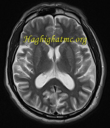 infective-case3-1.jpg