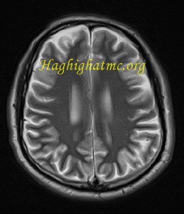 infective-case3-2.jpg