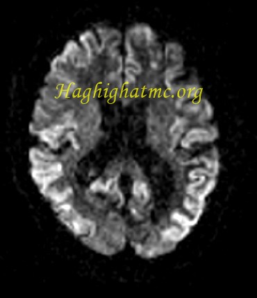 infective-case3-3.jpg