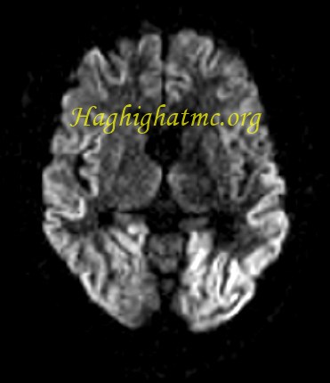 infective-case3-4.jpg