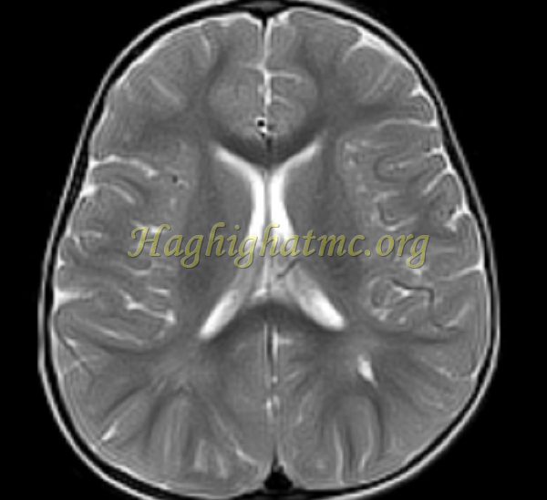 ped neuro4 a