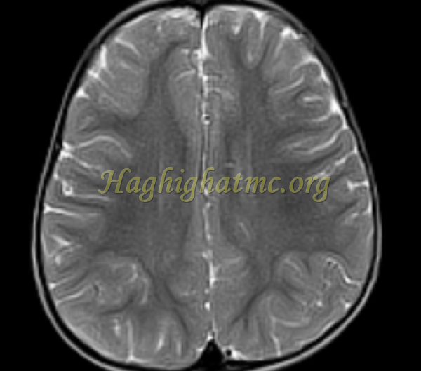 ped neuro4 b