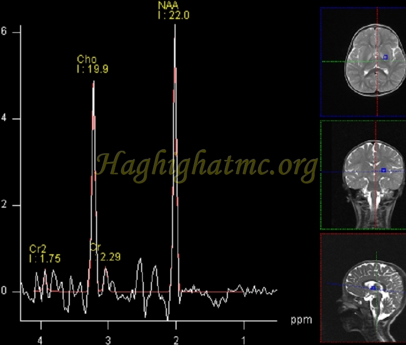ped neuro4 c