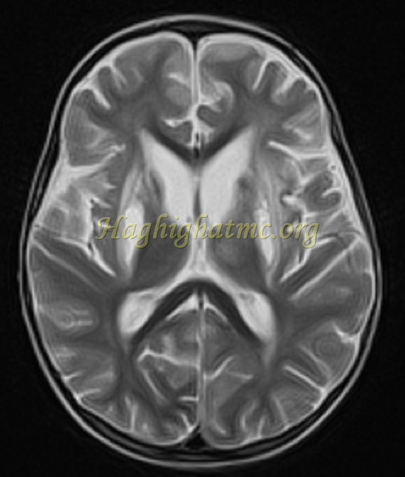 ped neuro5 a