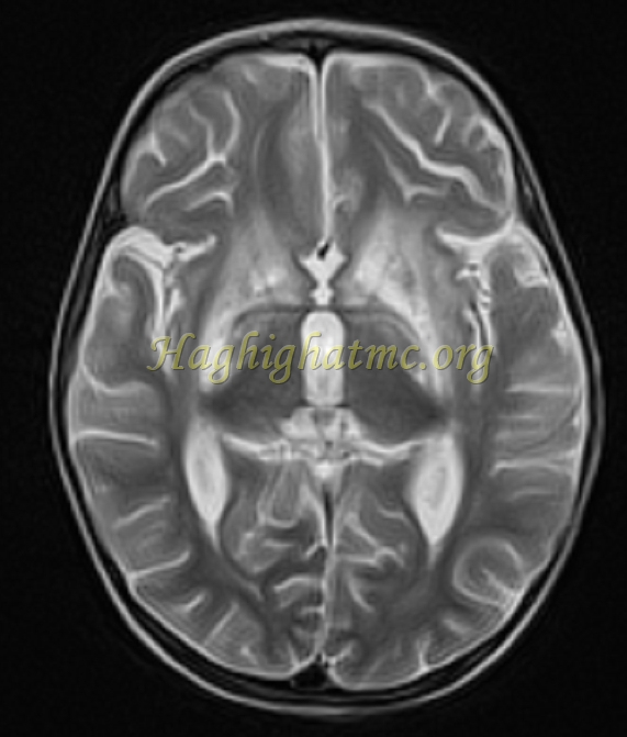 ped neuro5 b
