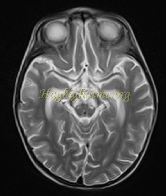 ped neuro5 c