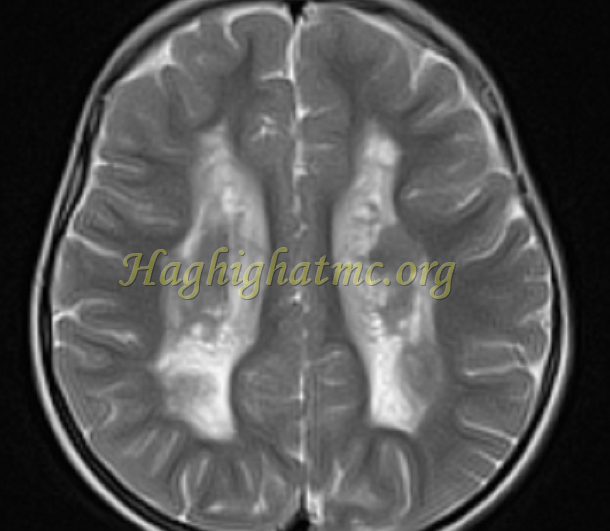 ped neuro6 a
