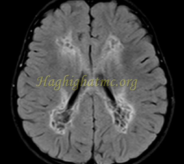 ped neuro6 b