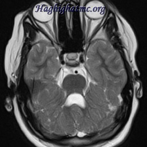 TSR Watermark - 311