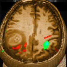 fMRI button fMRI button